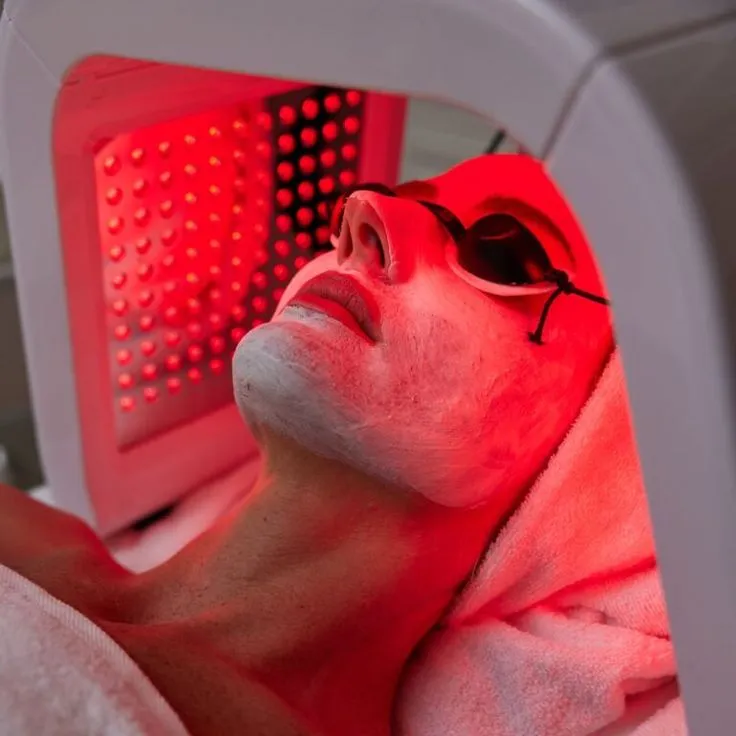 Terapia de luz LED aplicada ao rosto para rejuvenescimento da pele.